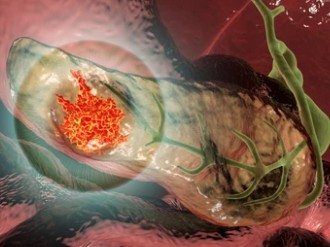Pancreatic-Cancer-Basic-Research-Services